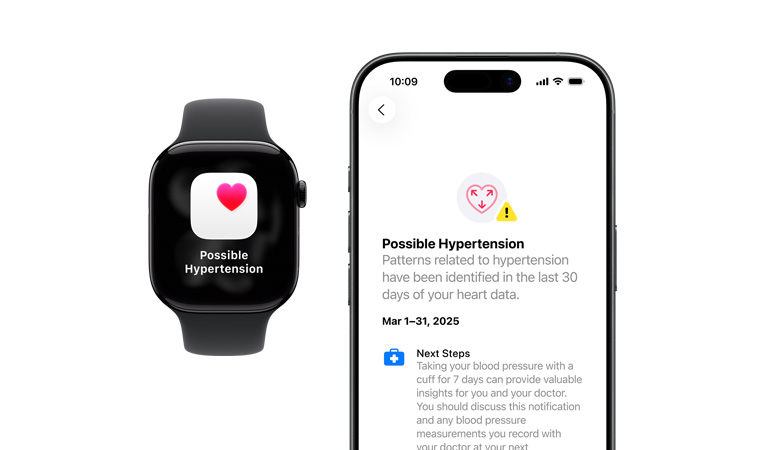 Oznámení o možné hypertenzi na Apple Watch Series 11, rozbalené oznámení na iPhonu