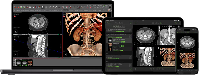 Software displaying the Visage app, which radiologists use to interpret large diagnostic files.